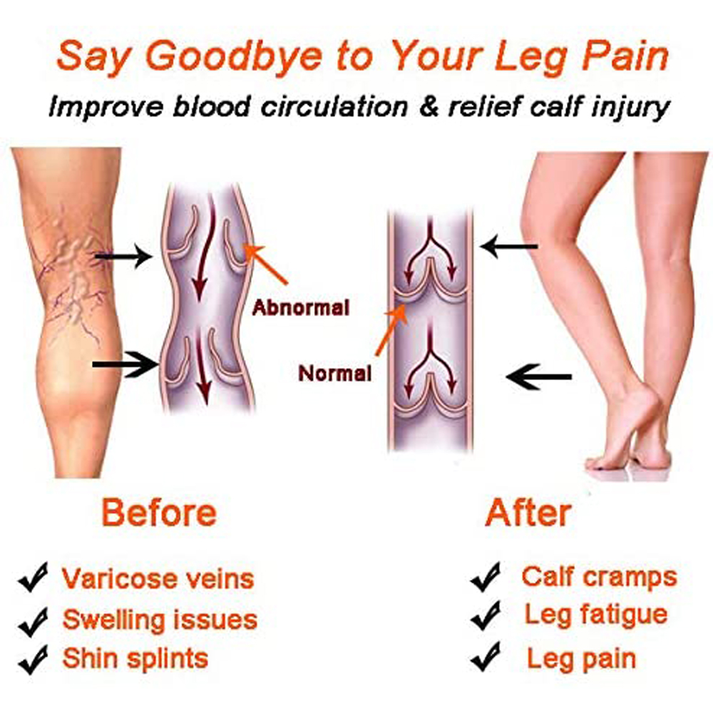 Kaus kaki kompresi kaki lengan - Compression Sleeve Calf ulasan dan harga