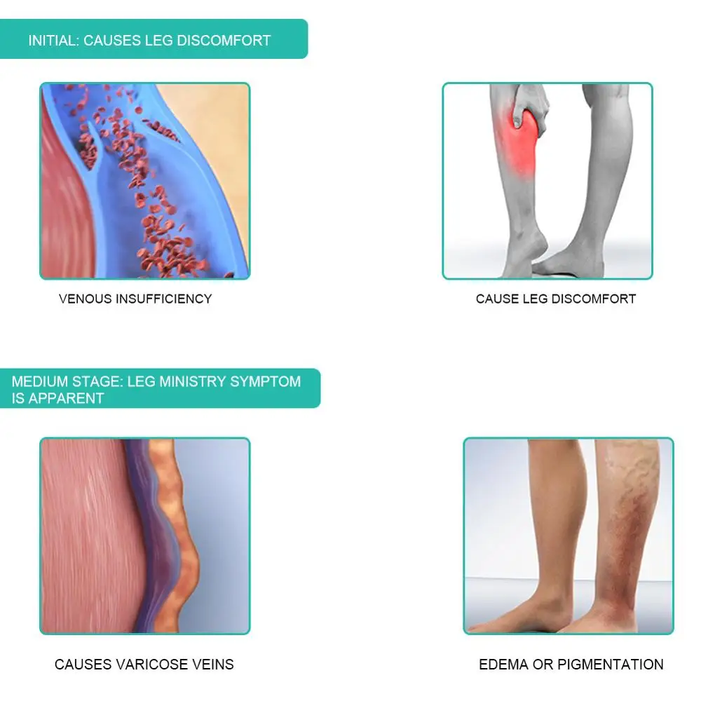 1 Pasang Medis Kompresi Kaus K - Compression Sock Medical ulasan dan harga