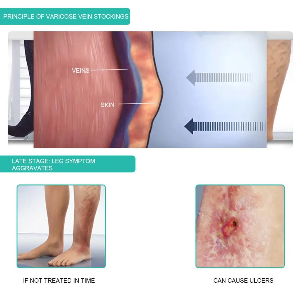 1 Pasang Medis Kompresi Kaus K - Compression Sock Medical ulasan dan harga